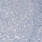 Immunohistochemical staining of human tonsil shows no positivity in lymphoid cells as expected.