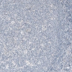 Immunohistochemical staining of human tonsil shows no positivity in lymphoid cells as expected.