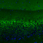 Immunofluorescence staining of rat hippocampus shows moderate positivity in glutamatergic fibers in granular cell layer of the dentate gyrus.