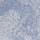 Immunohistochemical staining of human tonsil shows no positivity in lymphoid cells as expected.