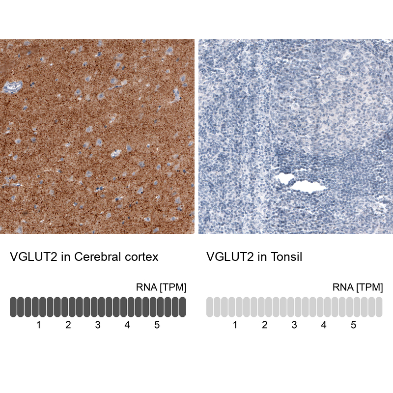 Anti-SLC17A6 Antibody