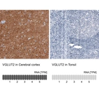 Anti-SLC17A6 Antibody