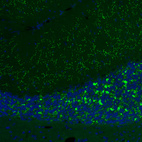 Anti-SLC17A6 Antibody