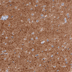 Immunohistochemical staining of human cerebral cortex shows strong positivity in neuropil.