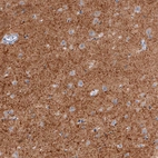 Immunohistochemical staining of human cerebral cortex shows strong positivity in neuropil.