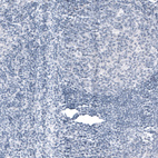 Immunohistochemical staining of human tonsil shows no positivity in lymphoid cells as expected.
