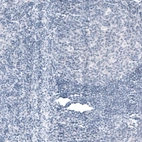 Immunohistochemical staining of human tonsil shows no positivity in lymphoid cells as expected.