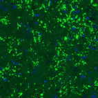 Immunohistochemical staining of rat thalamus shows strong immunoreactivity in glutamatergic synapses.