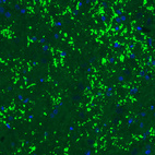 Anti-SLC17A6 Antibody