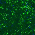 Immunohistochemical staining of rat thalamus shows strong immunoreactivity in glutamatergic synapses.