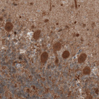 Anti-UCHL1 Antibody