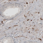 Immunohistochemical staining of human prostate shows staining in peripheral nerve fibers.