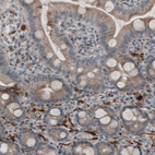 Anti-UCHL1 Antibody