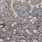 Immunohistochemical staining of human duodenum shows staining in peripheral nerve fibers.