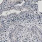 Anti-UCHL1 Antibody