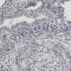 Immunohistochemical staining of human fallopian tube shows absence of immunoreactivity (negative control).