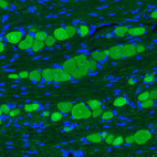 Immunohistochemical staining of mouse trigeminal ganglion shows strong immunoreactivity in primary sensory neurons.