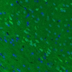 Immunohistochemical staining of rat cerebral cortex shows moderate immunoreactivity in neurons.