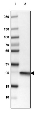 Lane 1: Marker [kDa] 250, 130, 100, 70, 55, 35, 25, 15, 10_br/_Lane 2: Human Cerebral Cortex tissue