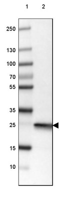 Anti-UCHL1 Antibody