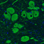 Anti-NEFM Antibody