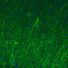 Immunohistochemical staining of mouse cerebral cortex shows strong immunoreactivity in neurofilaments.