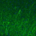 Immunohistochemical staining of mouse cerebral cortex shows strong immunoreactivity in neurofilaments.