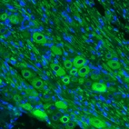 Immunohistochemical staining of mouse trigeminal ganglion shows strong immunoreactivity in ganglion cells.