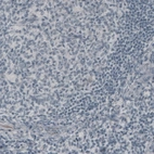 Immunohistochemical staining of human tonsil shows absence of immunoreactivity (negative control).
