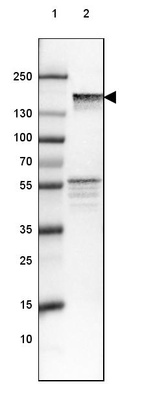 Lane 1: Marker [kDa] 250, 130, 100, 70, 55, 35, 25, 15, 10_br/_Lane 2: Human Cerebral Cortex tissue