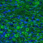 Immunohistochemical staining of mouse trigeminal ganglion shows strong immunoreactivity in ganglion cells.