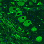 Immunohistochemical staining of rat brainstem shows strong positivity in neurons of mesencephalic trigeminal nucleus.