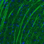Immunohistochemical staining of mouse thalamus shows strong positivity in neural fibers.