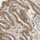 Immunohistochemical staining of human fallopian tube shows moderate nuclear positivity in glandular cells.