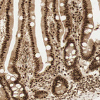 Immunohistochemical staining of human duodenum shows strong nuclear positivity in glandular cells.