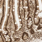 Immunohistochemical staining of human duodenum shows strong nuclear positivity in glandular cells.