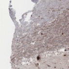 Anti-GPRASP1 Antibody