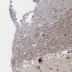 Anti-GPRASP1 Antibody