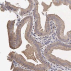 Anti-PABPC5 Antibody