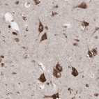 Anti-PABPC5 Antibody