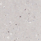 Anti-DKC1 Antibody