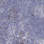 Anti-DKC1 Antibody