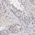 Anti-DKC1 Antibody