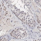 Immunohistochemical staining of human testis shows strong positivity in nucleoli in cells in seminiferous ducts.