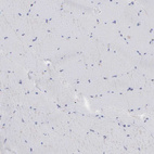 Anti-DKC1 Antibody