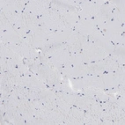 Immunohistochemical staining of human skeletal muscle shows no positivity in myocytes as expected.