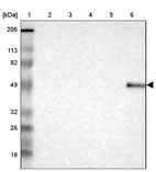 Lane 1: Marker [kDa] 206, 113, 82, 49, 32, 26, 18_br/_Lane 2: Human cell line RT-4_br/_Lane 3: Human cell line U-251MG sp_br/_Lane 4: Human cell line A-431_br/_Lane 5: Human liver tissue_br/_Lane 6: Human tonsil tissue