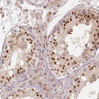 Anti-MUM1L1 Antibody