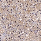 Anti-CHRDL1 Antibody