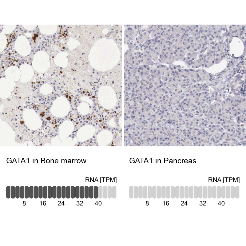 Anti-GATA1 Antibody
